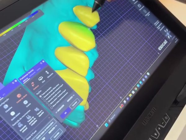 🦷 Por que usar a Wacom no seu projeto de prótese dentária? 🦷