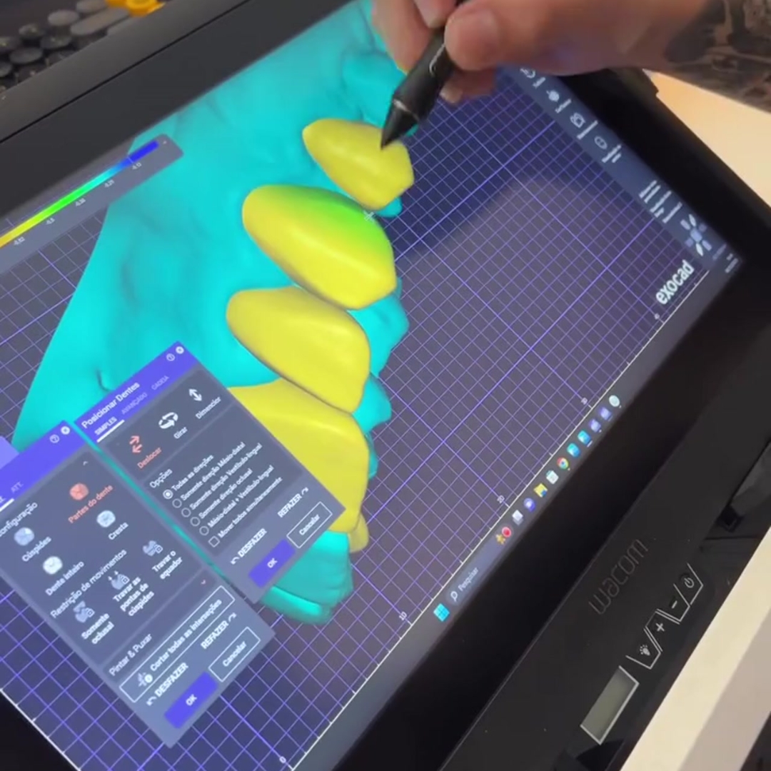 🦷 Por que usar a Wacom no seu projeto de prótese dentária? 🦷